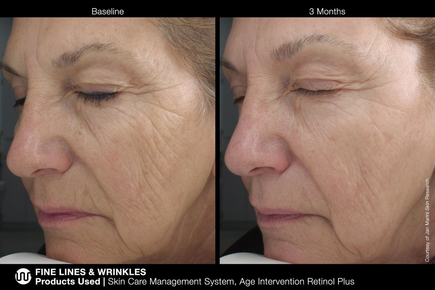 Age Intervention Retinol Plus